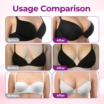 【Official Flagship Store】Purelora® Targeted Breast Enhancement Advanced Nano Microneedle Patch